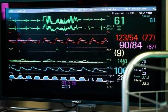 Craintes de conséquences pour les patients vivant avec une MCV